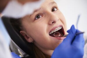 Girl with braces during a routine, dental examination