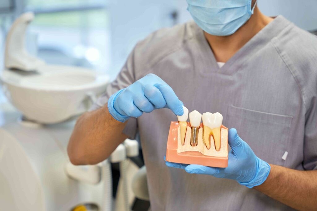 Dental Implants: A Permanent Solution for Missing Teeth