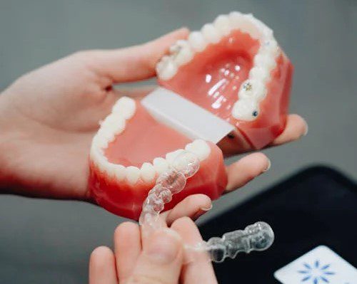 How to Clean Invisalign Properly