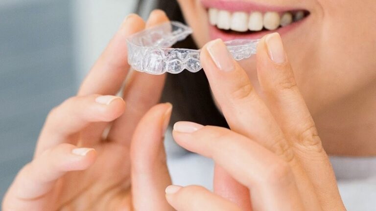 Daily Invisalign Habits for Austin Patients