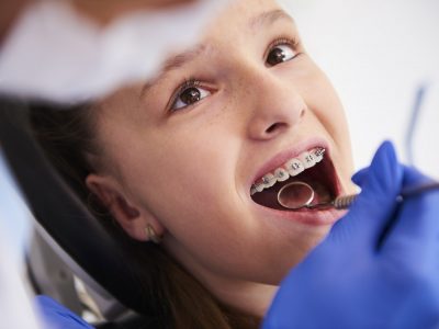 Girl with braces during a routine, dental examination